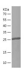 Recombinant Dog cTnI