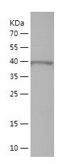    IL17RB / Recombinant Human IL17RB