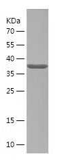    STK32A / Recombinant Human STK32A