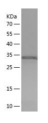    TPM3 / Recombinant Human TPM3