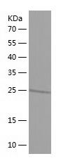    TFAP4 / Recombinant Human TFAP4