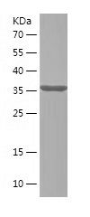    ECM1 / Recombinant Human ECM1