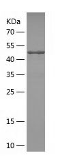    CAD / Recombinant Human CAD