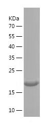    COL15A1 / Recombinant Human COL15A1