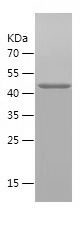    SQLE / Recombinant Human SQLE