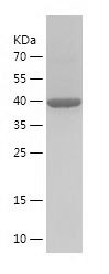    Calreticulin / Recombinant Human Calreticulin