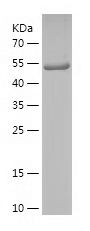    CLEC11A / Recombinant Human CLEC11A