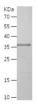    DLL4 / Recombinant Human DLL4