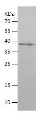    DCLK1 / Recombinant Human DCLK1