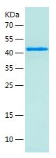    FTCD / Recombinant Human FTCD