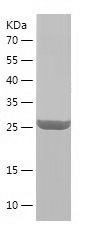    IGF2BP2 / Recombinant Human IGF2BP2