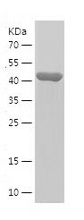    CCHCR1 / Recombinant Human CCHCR1