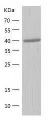    GDAP2 / Recombinant Human GDAP2