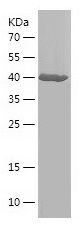    CEMIP / Recombinant Human CEMIP