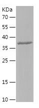    HYAL2 / Recombinant Human HYAL2