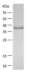    MAOB / Recombinant Human MAOB