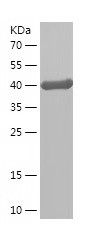    TDP43 / Recombinant Human TDP43