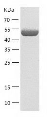    CYP2E1 / Recombinant Human CYP2E1