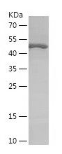    RPS6KB1 / Recombinant Human RPS6KB1