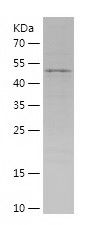    GCLC / Recombinant Human GCLC