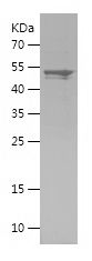    PALLD / Recombinant Human PALLD