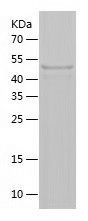    ANKRD13A / Recombinant Human ANKRD13A