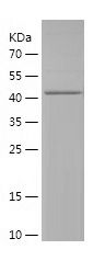    UBA5 / Recombinant Human UBA5