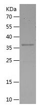    PARP2 / Recombinant Human PARP2