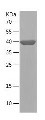    GPX8 / Recombinant Human GPX8