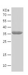    MCHR1 / Recombinant Human MCHR1