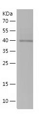    PCYT1B / Recombinant Human PCYT1B