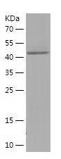    PSMC3IP / Recombinant Human PSMC3IP