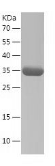    GABRG2-2 / Recombinant Human GABRG2-2