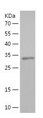    HCRTR1 / Recombinant Human HCRTR1