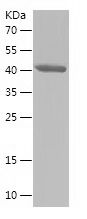    PRDX2 / Recombinant Human PRDX2