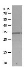    DPEP1 / Recombinant Human DPEP1