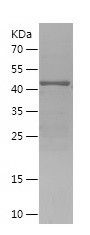    DACH1 / Recombinant Human DACH1