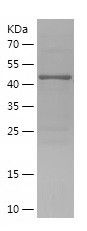    DCAF1 / Recombinant Human DCAF1
