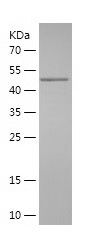    ZEB2 / Recombinant Human ZEB2