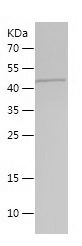    ARPC1B / Recombinant Human ARPC1B