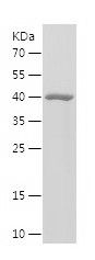    CAPN1 / Recombinant Human CAPN1