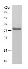    ACKR2 / Recombinant Human ACKR2