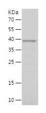    C9orf72 / Recombinant Human C9orf72