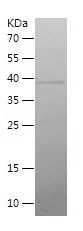    DYNC1H1 / Recombinant Human DYNC1H1