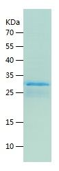    SLC25A3 / Recombinant Human SLC25A3