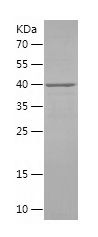    TMEM67 / Recombinant Human TMEM67