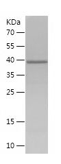    KLF4 / Recombinant Human KLF4