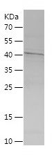    TCTN1 / Recombinant Human TCTN1