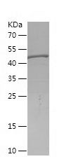    GBP2 / Recombinant Human GBP2