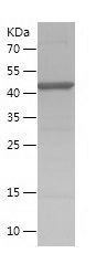    RAB27B / Recombinant Human RAB27B